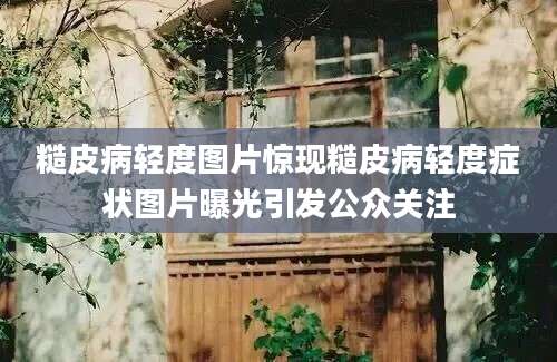 糙皮病轻度图片惊现糙皮病轻度症状图片曝光引发公众关注